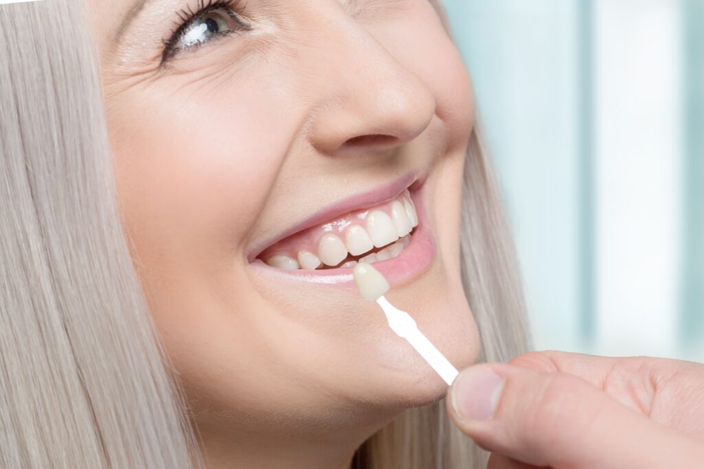 Can You Go Back to Normal Teeth After Dental Veneers?